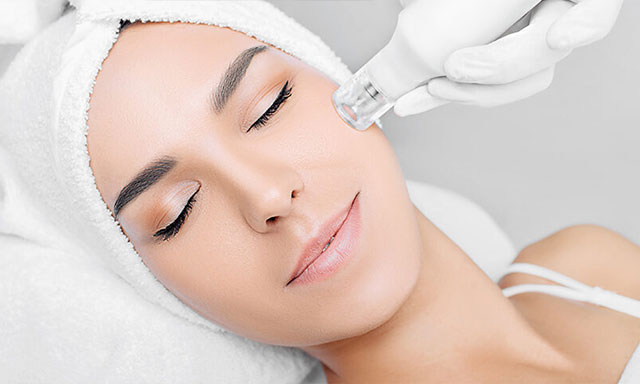 Kosmetik Microneedeling Stuttgart